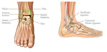 lábszár részei boka osteoarthritis kezelése