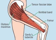 dysplasia csípőízület fájdalom