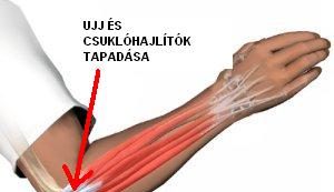 a csípőízület deformáló artrózisa 2 mi kezeli a rheumatoid arthrosisot